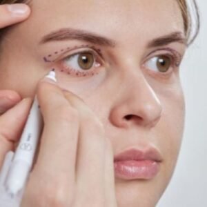 Blefaroplastia Inferior em Curitiba Cirurgia da Face