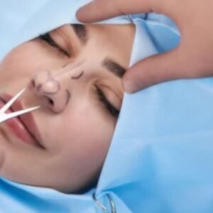 Cirurgia de Rinoplastia em Curitiba