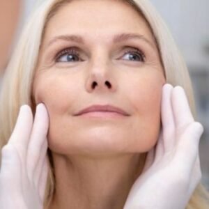 Ritidoplastia em Curitiba Cirurgia Lifting Facial em Curitiba