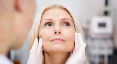 Famosas que aderiram à técnica de rejuvenescimento com lifting facial