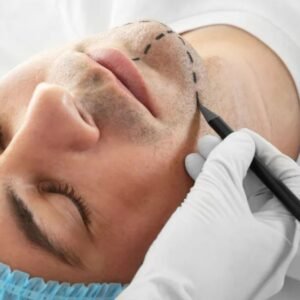Lifting Facial Masculino em Curitiba