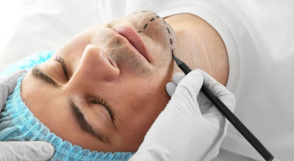 Lifting Facial Masculino em Curitiba